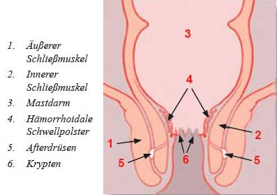 Analvenenthrombose unterschied hämorrhoiden Analthrombose (Analvenenthrombose):